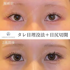 LOUIS CLINIC 二子玉川院【ルイクリニック】 小松 塁医師の症例