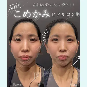 パーソナルビューティークリニック東京 【PBC TOKYO 銀座店】 岡本 笑奈医師の症例