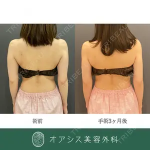 症例