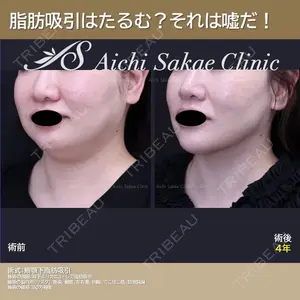 症例