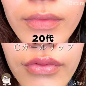 症例