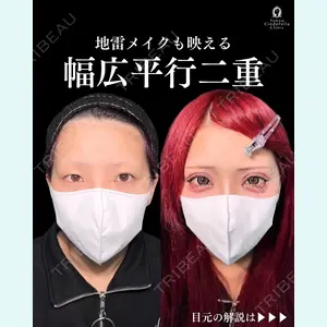 症例