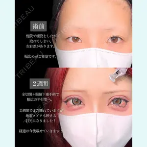 症例