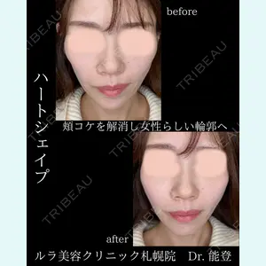 ルラ美容クリニック 札幌院 能登 貴弘医師の症例
