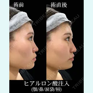 HAAB×DREAM BEAUTY CLINIC 東京本院 佐野 圭医師の症例