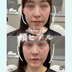 BIANCA銀座 明石 仙姫医師の症例