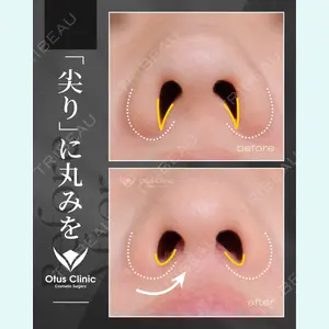 症例