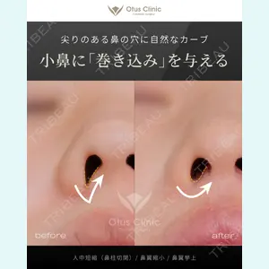 症例
