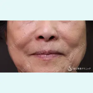 症例