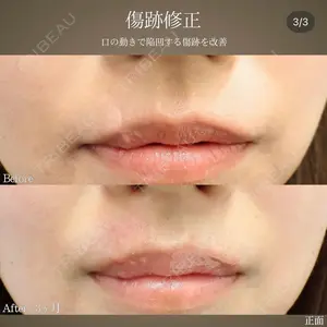 BIANCA銀座 魚谷 雄一朗医師の症例