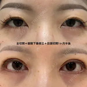 エターナル美容クリニック 久門田 詳医師の症例