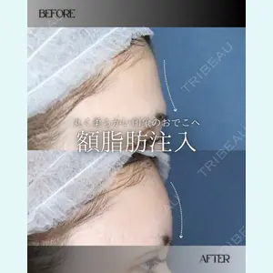 小倉美容外科/美容皮膚科 ビラビューティークリニック 大村 亞蘭医師の症例