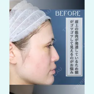 小倉美容外科/美容皮膚科 ビラビューティークリニック 大村 亞蘭医師の症例