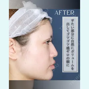 小倉美容外科/美容皮膚科 ビラビューティークリニック 大村 亞蘭医師の症例