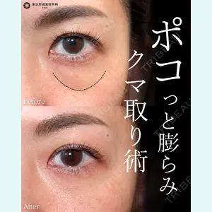 東京形成美容外科 船橋院 弓削田　浩主医師の症例