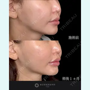 東京形成美容外科 船橋院 山崎 修吾医師の症例