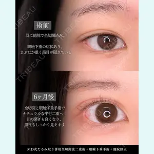 症例