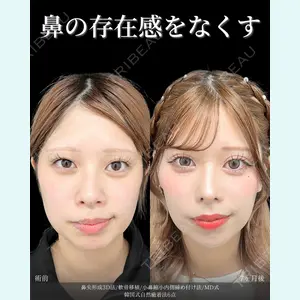 症例