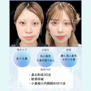 症例