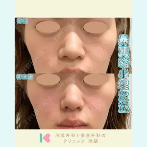 症例