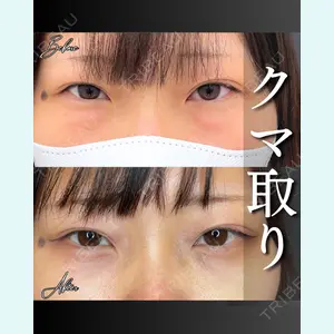 症例
