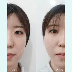 L‘amour clinic Tokyo【ラムールクリニック東京】の症例