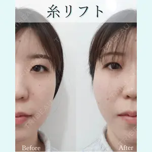 L‘amour clinic Tokyo【ラムールクリニック東京】の症例