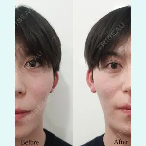 L‘amour clinic Tokyo【ラムールクリニック東京】の症例