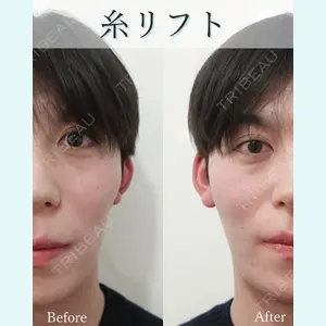 L‘amour clinic Tokyo【ラムールクリニック東京】の症例