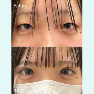 症例