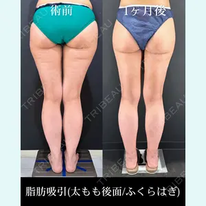 症例