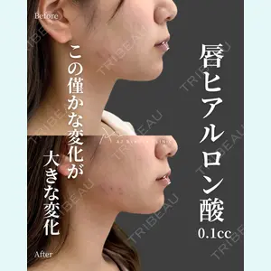 AZ BEAUTY CLINIC 木村 潤医師の症例