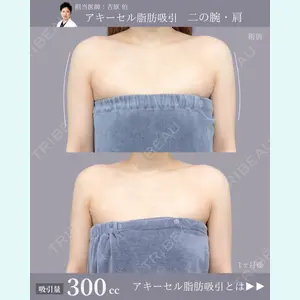 症例