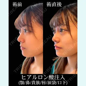 HAAB×DREAM BEAUTY CLINIC 東京本院 佐野 圭医師の症例