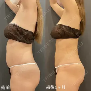 症例