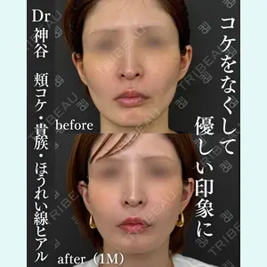 症例