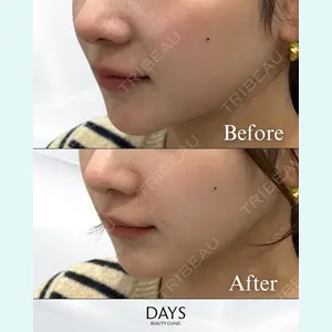 Days Beauty Clinic 蟹谷 莉麻医師の症例