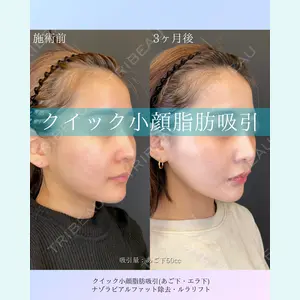 ルラ美容クリニック 札幌院 佐藤 雄紀医師の症例