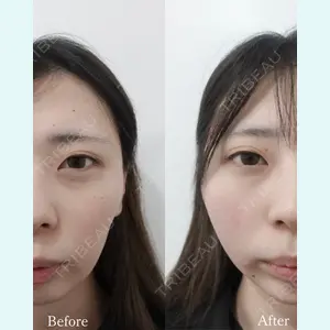 L‘amour clinic Tokyo【ラムールクリニック東京】の症例