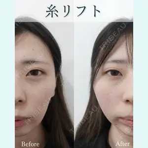 L‘amour clinic Tokyo【ラムールクリニック東京】の症例