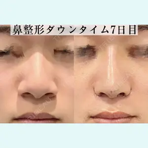 症例