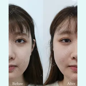 L‘amour clinic Tokyo【ラムールクリニック東京】の症例