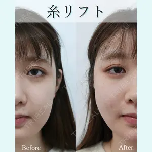 L‘amour clinic Tokyo【ラムールクリニック東京】の症例
