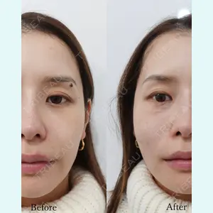 L‘amour clinic Tokyo【ラムールクリニック東京】の症例