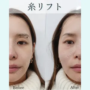 L‘amour clinic Tokyo【ラムールクリニック東京】の症例