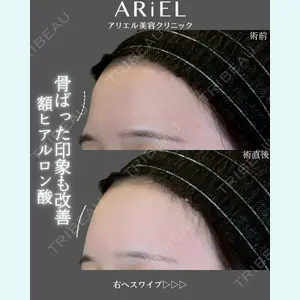 アリエル美容クリニック 郡山院 安齋 誠基医師の症例