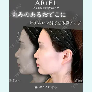 アリエル美容クリニック 郡山院 安齋 誠基医師の症例