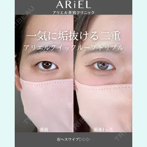 アリエル美容クリニック 郡山院 安齋 誠基医師の症例