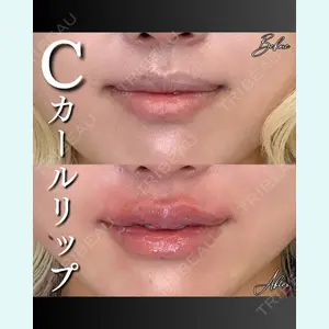 症例