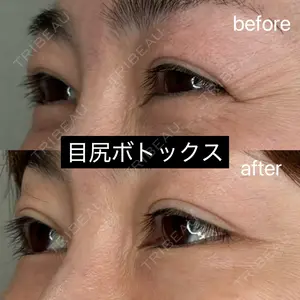 症例